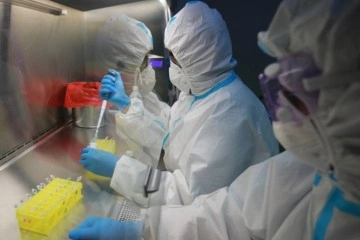 Japon biyoteknoloji firması iplik solucanlarıyla pankreas kanserini teşhis etmeyi başardı